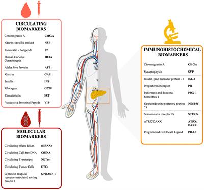 Biomarkers for Pancreatic Neuroendocrine Neoplasms (PanNENs) Management—An Updated Review